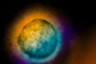 Una particella di virus Nipah&nbsp;