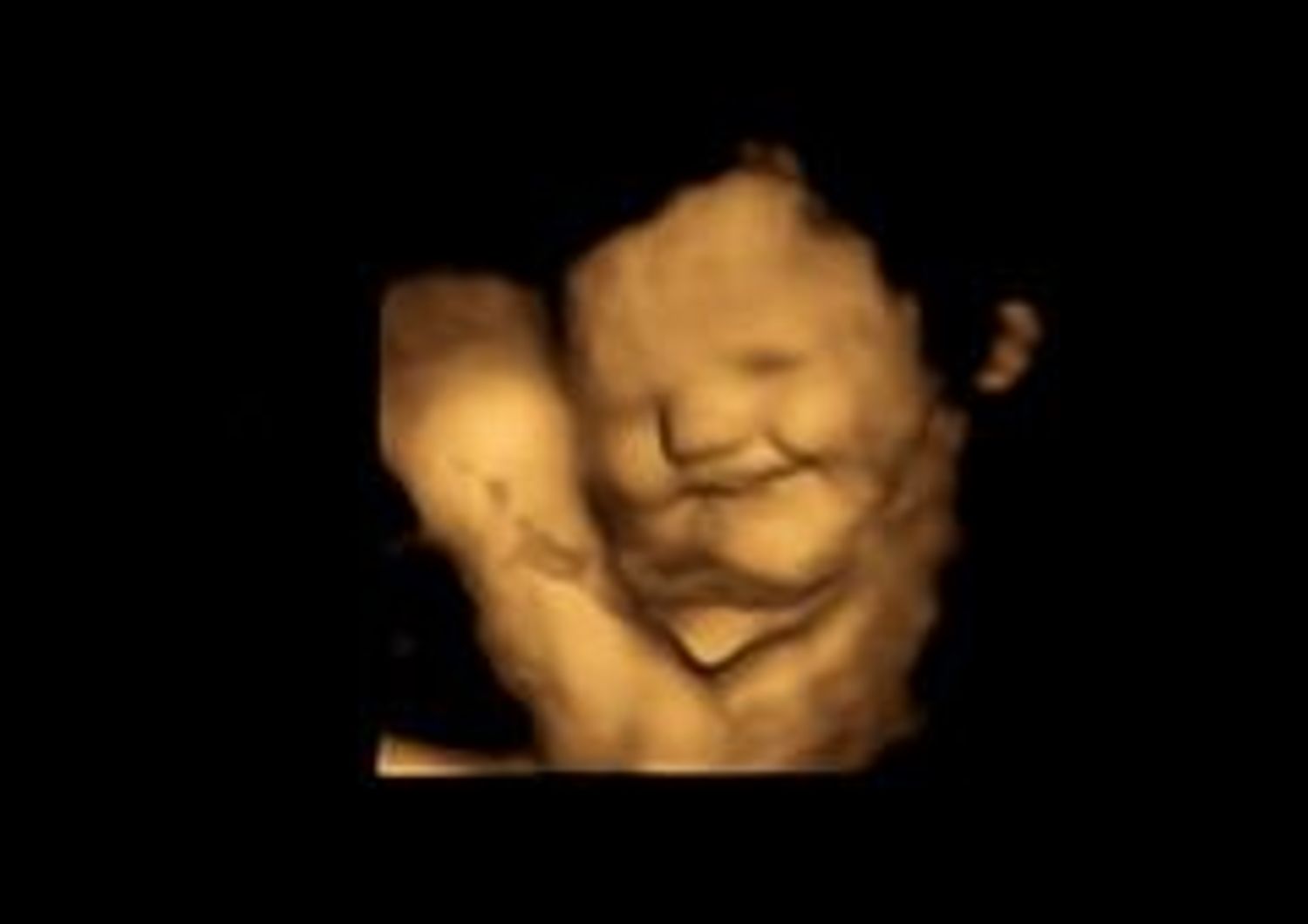 Il feto reagisce ai sapori