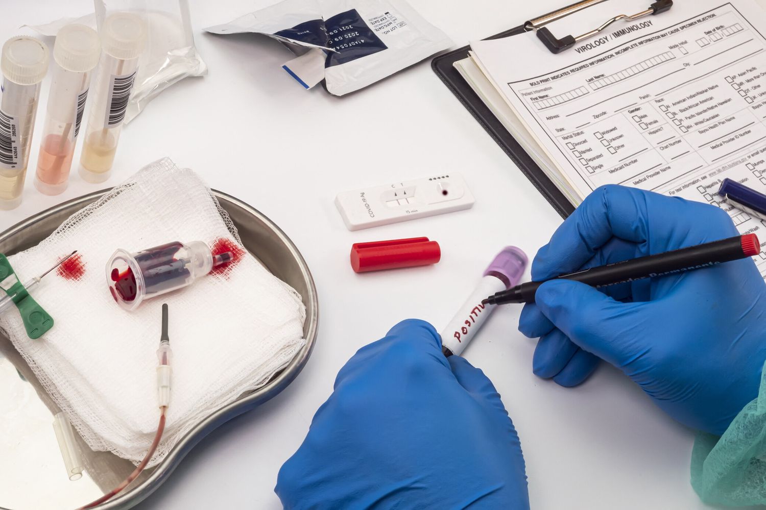 Esami per il Covid 19