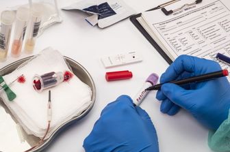 Esami per il Covid 19