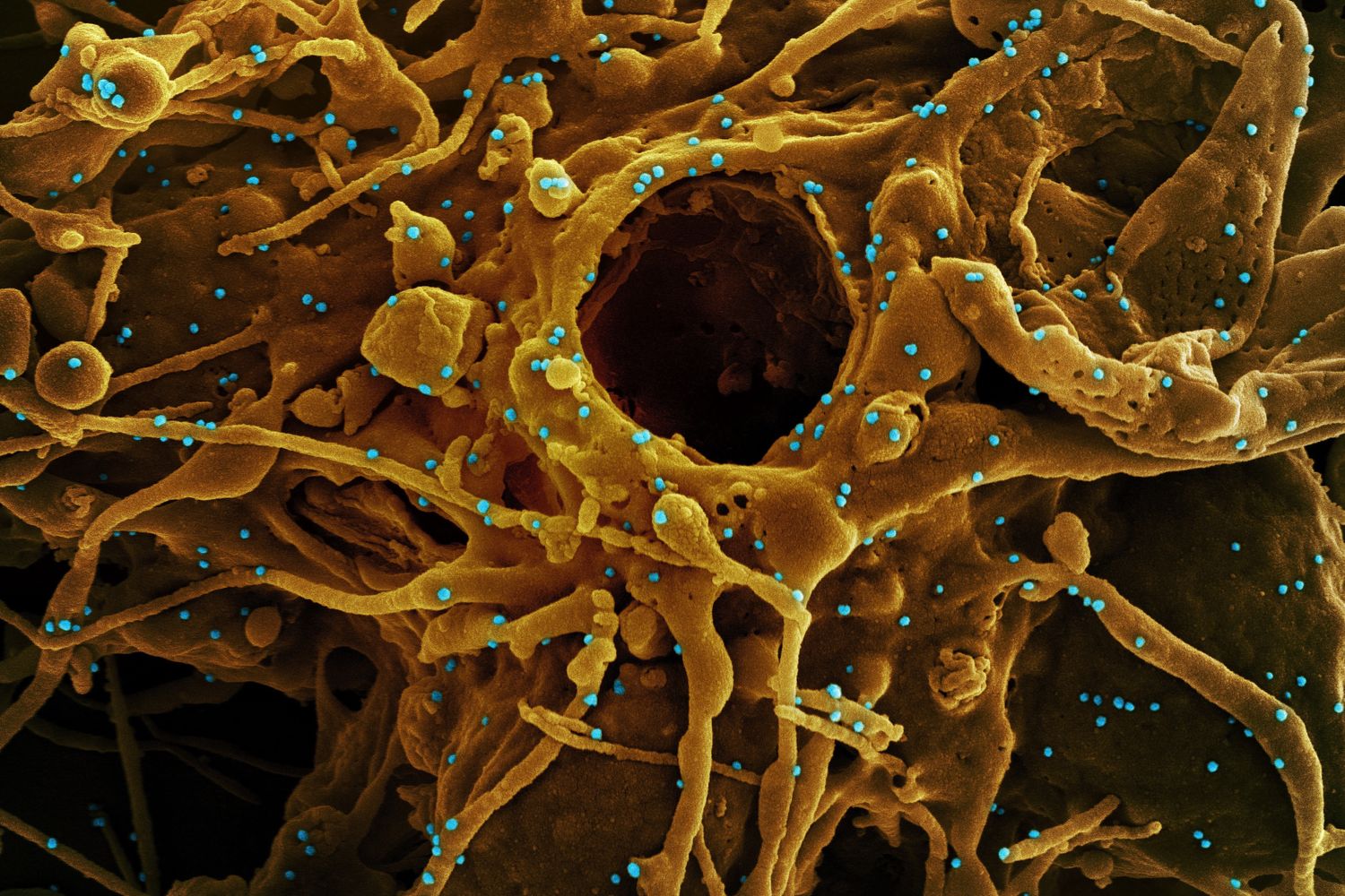 Il Sars Cov 2 osservato al microscopio&nbsp;