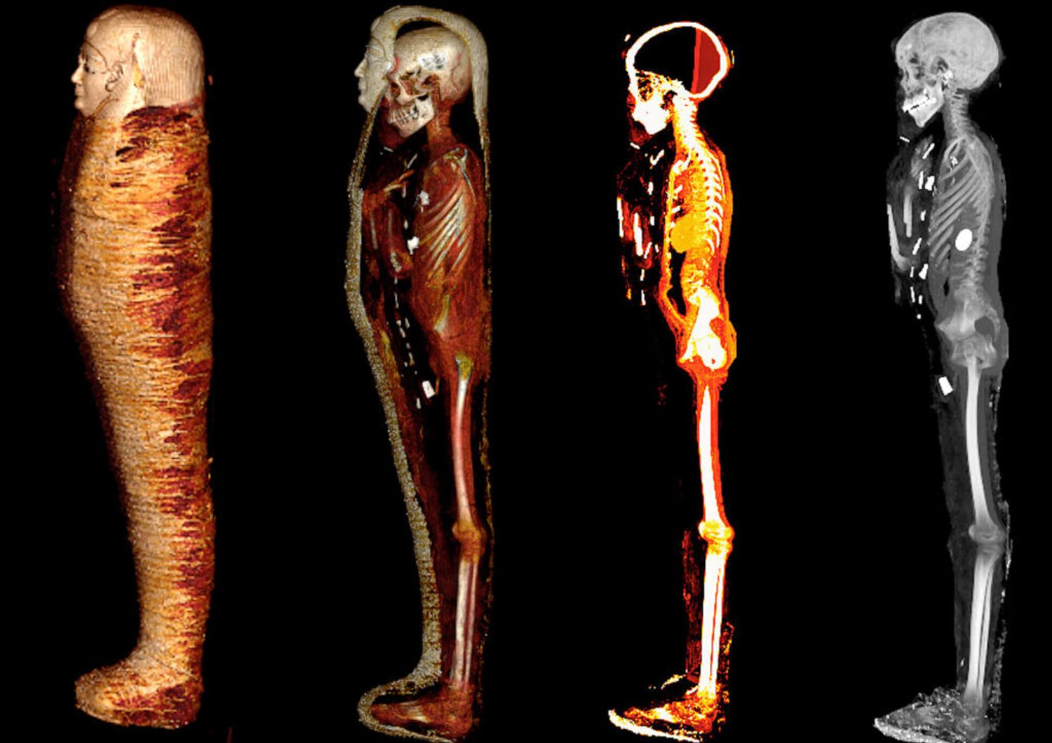mummia protetta da 49 amuleti