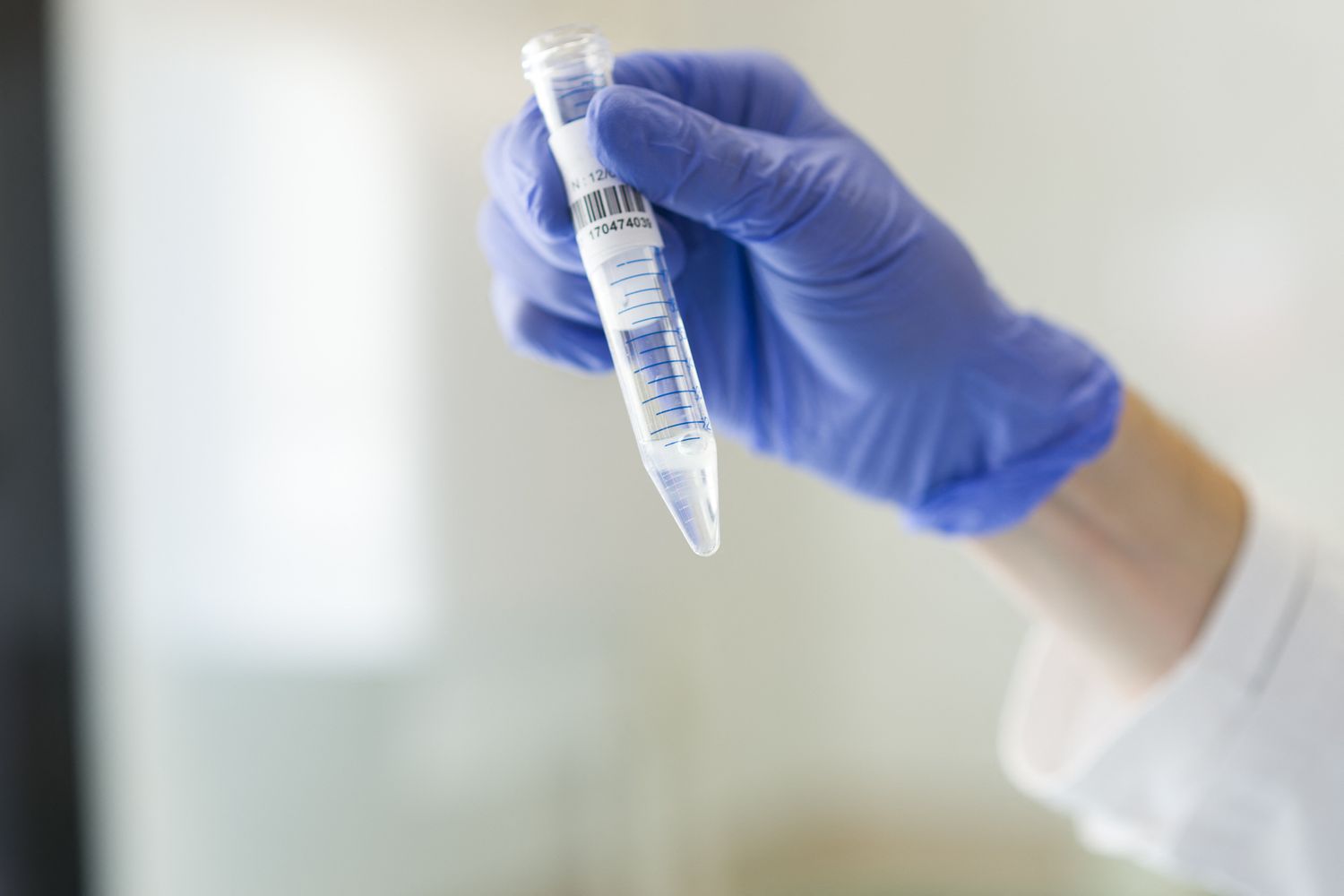 Un campione di sperma