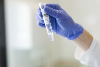 Un campione di sperma