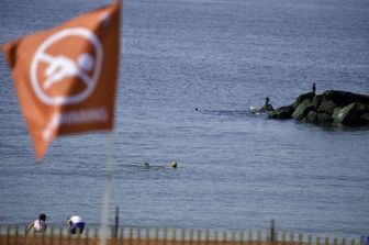 donna attaccata squalo new york&nbsp;