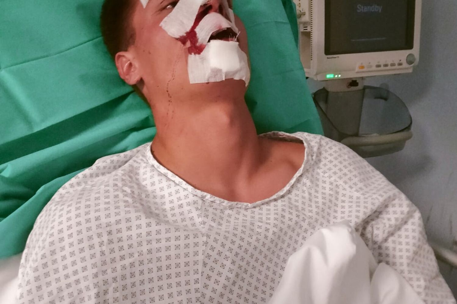 &nbsp;Il giovane derubato e sfigurato