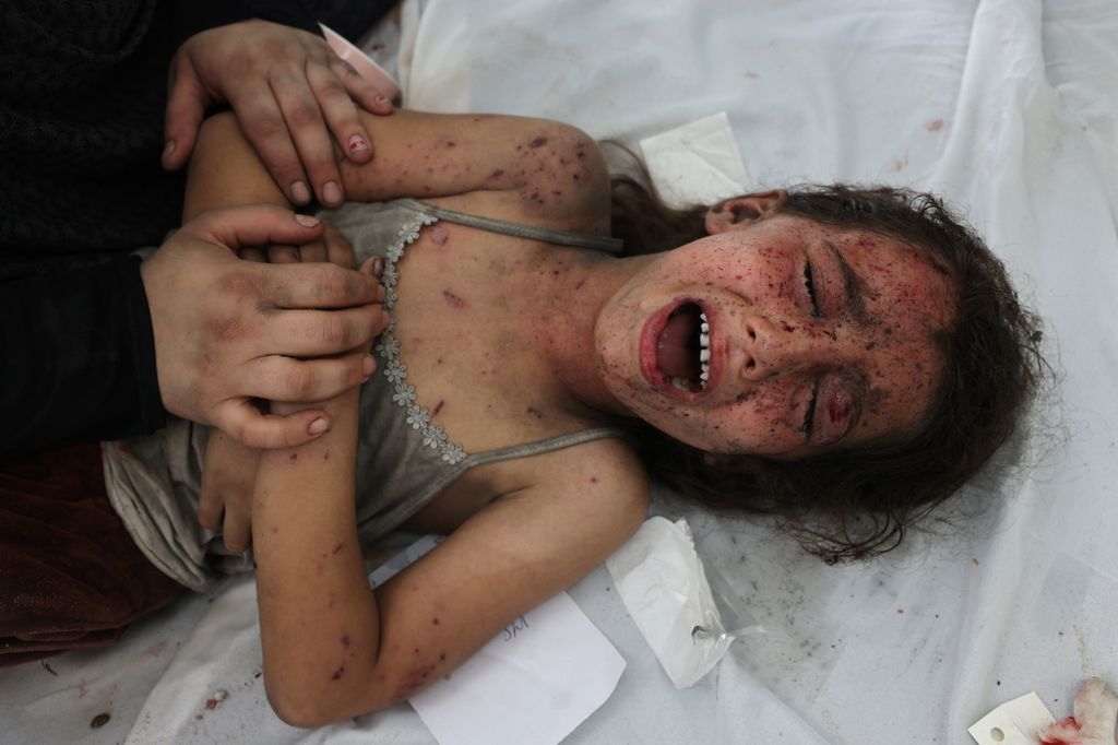 Una bambina ferita a Gaza