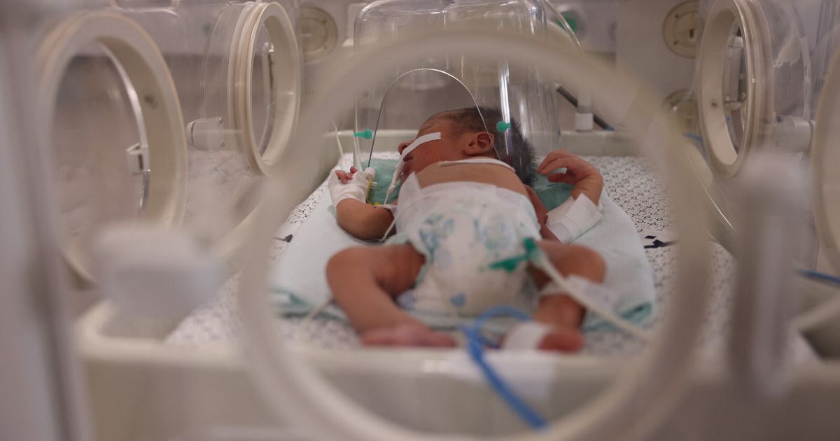 una neonata prematura di 600 grammi operata al cuore sta bene