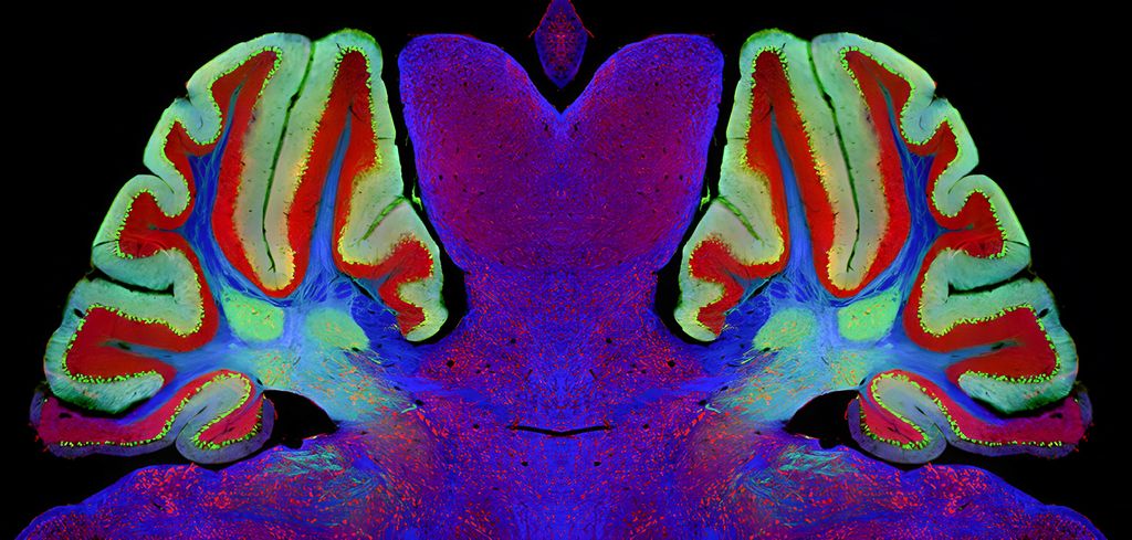 &nbsp;Immagine medica del cervello del topo