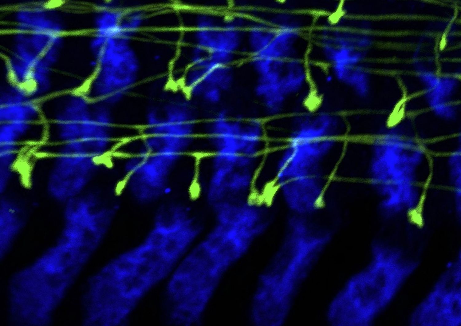 mappa cervello topi rivela rende umani atlante cellule