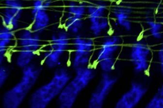 mappa cervello topi rivela rende umani atlante cellule