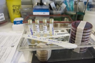 Laboratorio per la rilevazione di allergeni