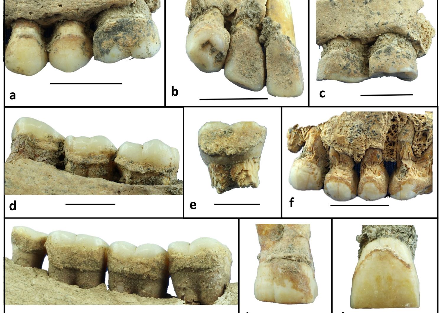 tartaro dentale 6mila anni fa rivela dieta neolitica