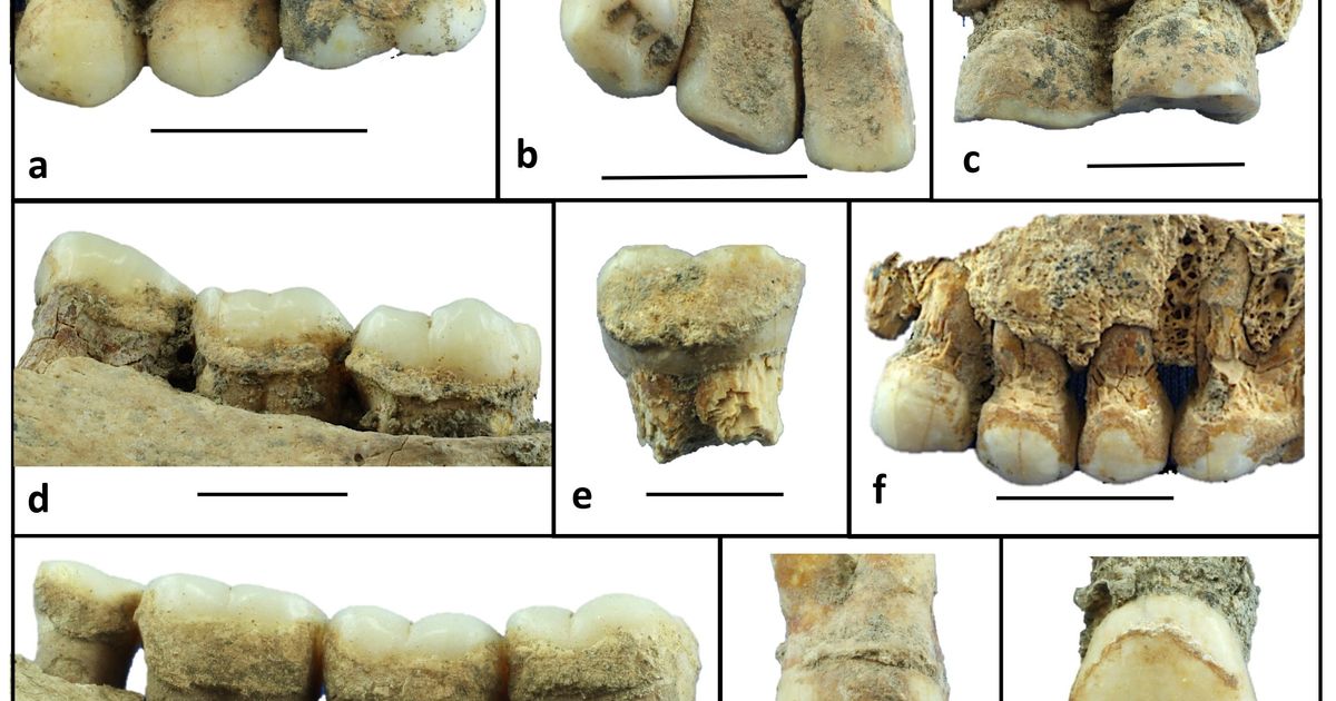 Le tartre dentaire d’il y a 6 000 ans révèle le régime alimentaire néolithique