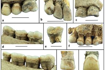 tartaro dentale 6mila anni fa rivela dieta neolitica