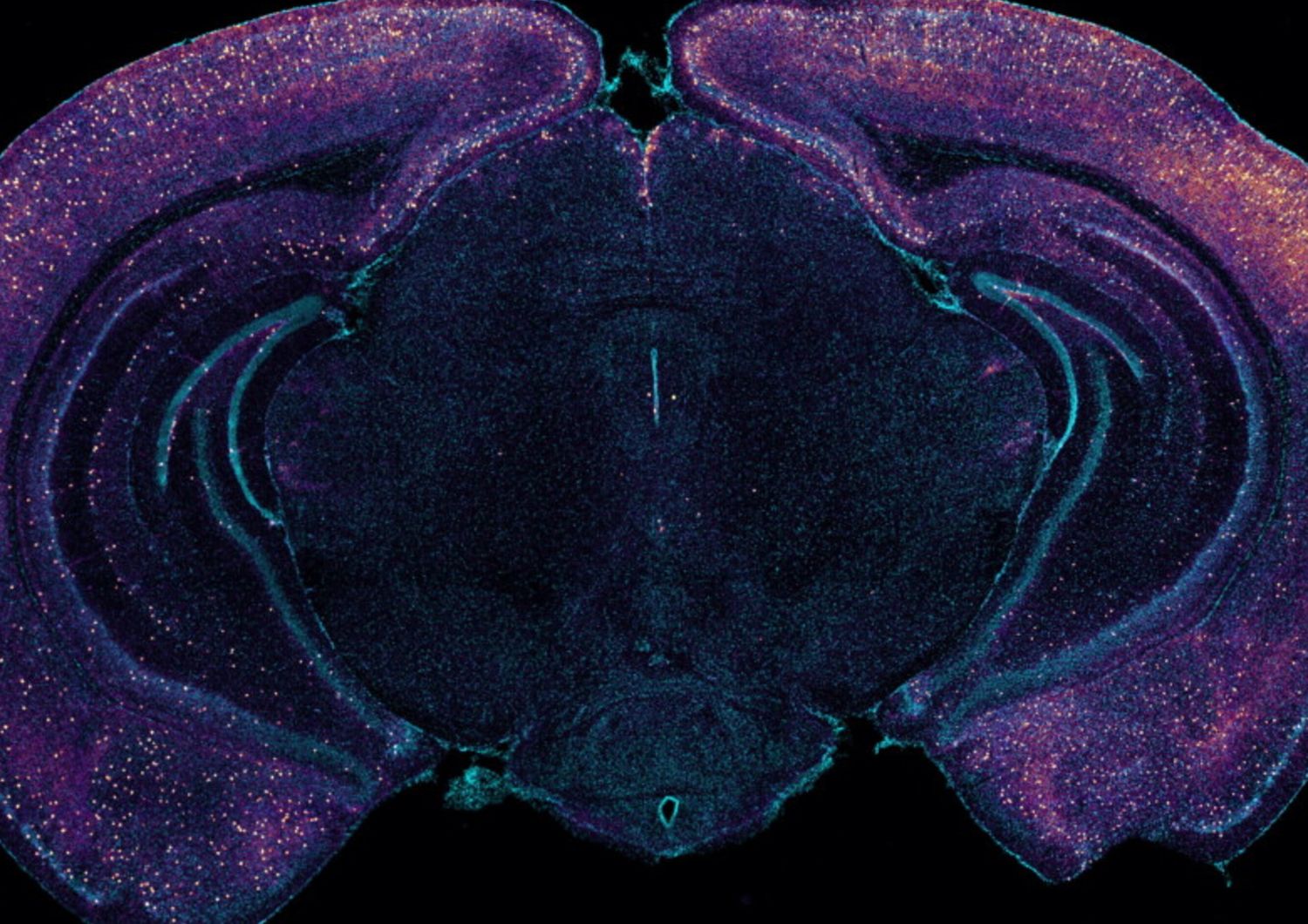 La colorazione brillante evidenzia gli interneuroni che esprimono VIP in questa sezione trasversale coronale di un cervello di topo
