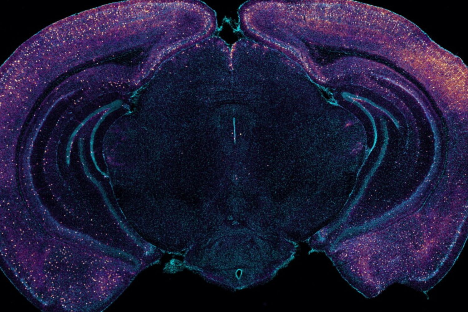 La colorazione brillante evidenzia gli interneuroni che esprimono VIP in questa sezione trasversale coronale di un cervello di topo