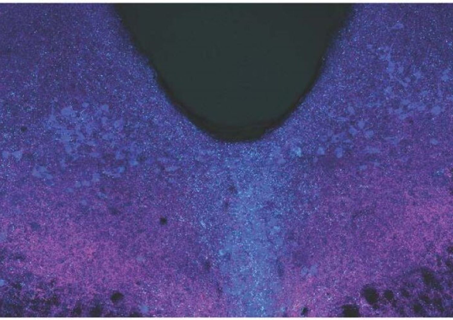 L’area dorsale del rafe del cervello viene ripresa mediante microscopia confocale