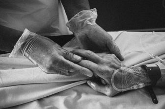 Paziente affetto da Parkinson