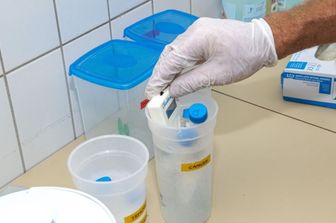salute test urine cancro prostata