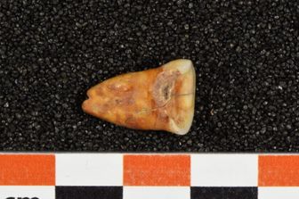 Dente umano proveniente dalla grotta Taforalt in Marocco, che mostra grave usura e carie