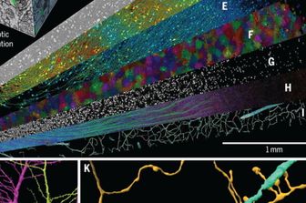 ricerca ricostruzione 3d tessuto cerebrale umano