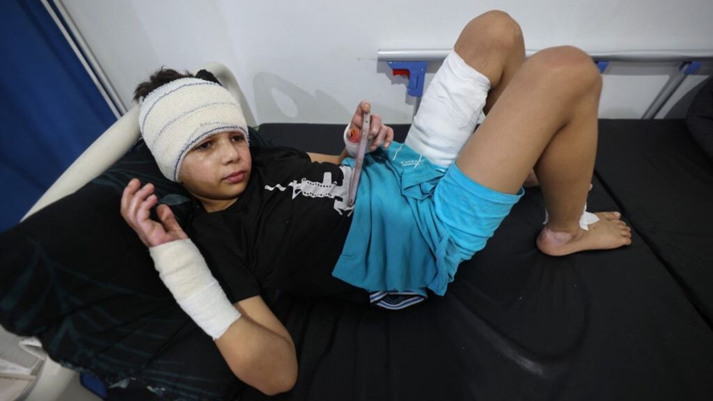 Bambino curato all’ospedale di Rafah