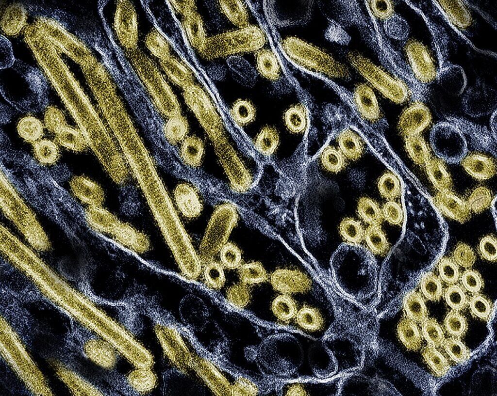 Micrografia elettronica a trasmissione colorata di particelle del virus dell’influenza aviaria A H5N1 (oro), coltivate in cellule epiteliali di Madin-Darby Canine Kidney (MDCK). Microscopia del CDC; riposizionato e ricolorato dal NIAID