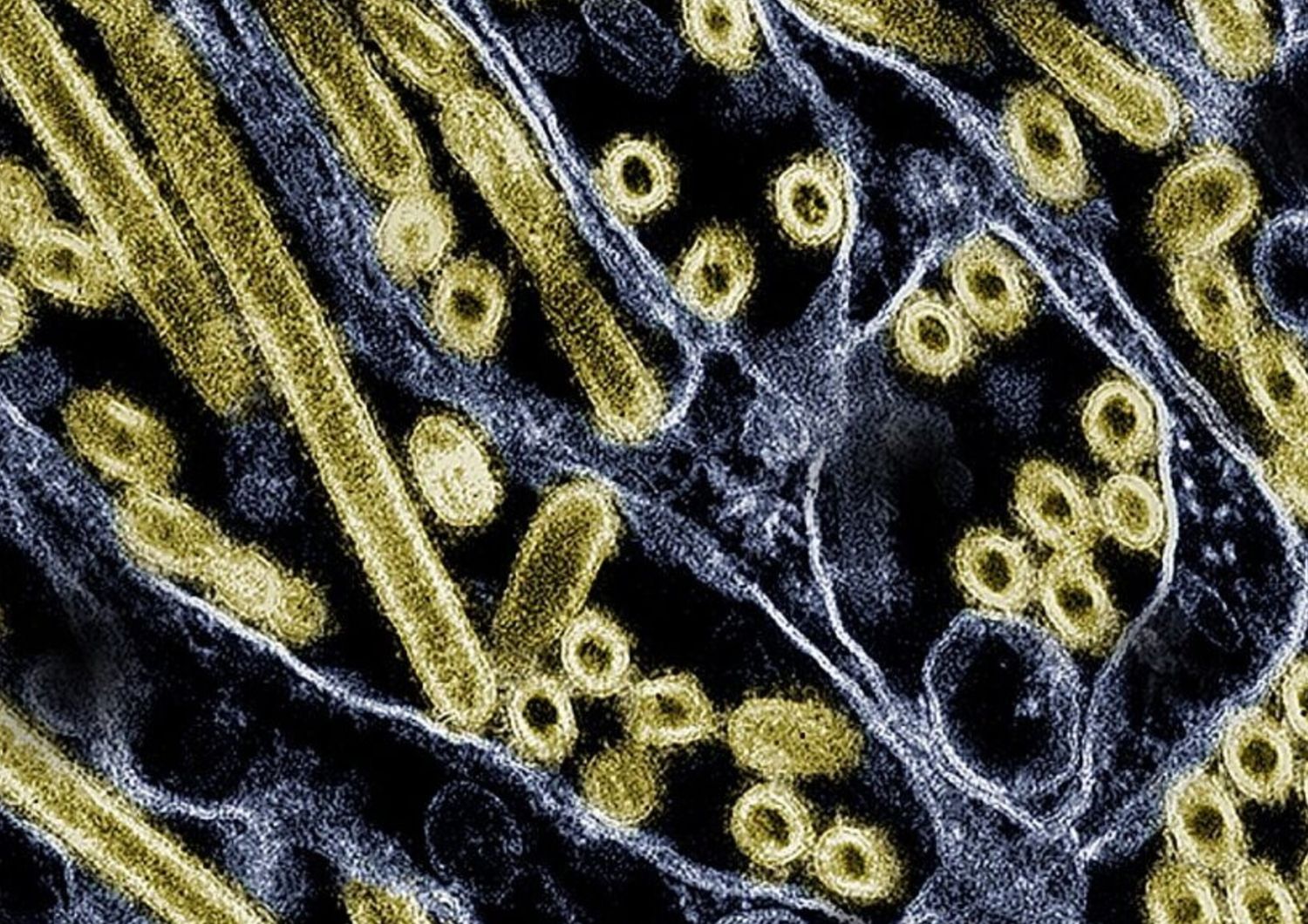 Micrografia elettronica a trasmissione colorata di particelle del virus dell’influenza aviaria A H5N1 (oro), coltivate in cellule epiteliali di Madin-Darby Canine Kidney (MDCK). Microscopia del CDC; riposizionato e ricolorato dal NIAID