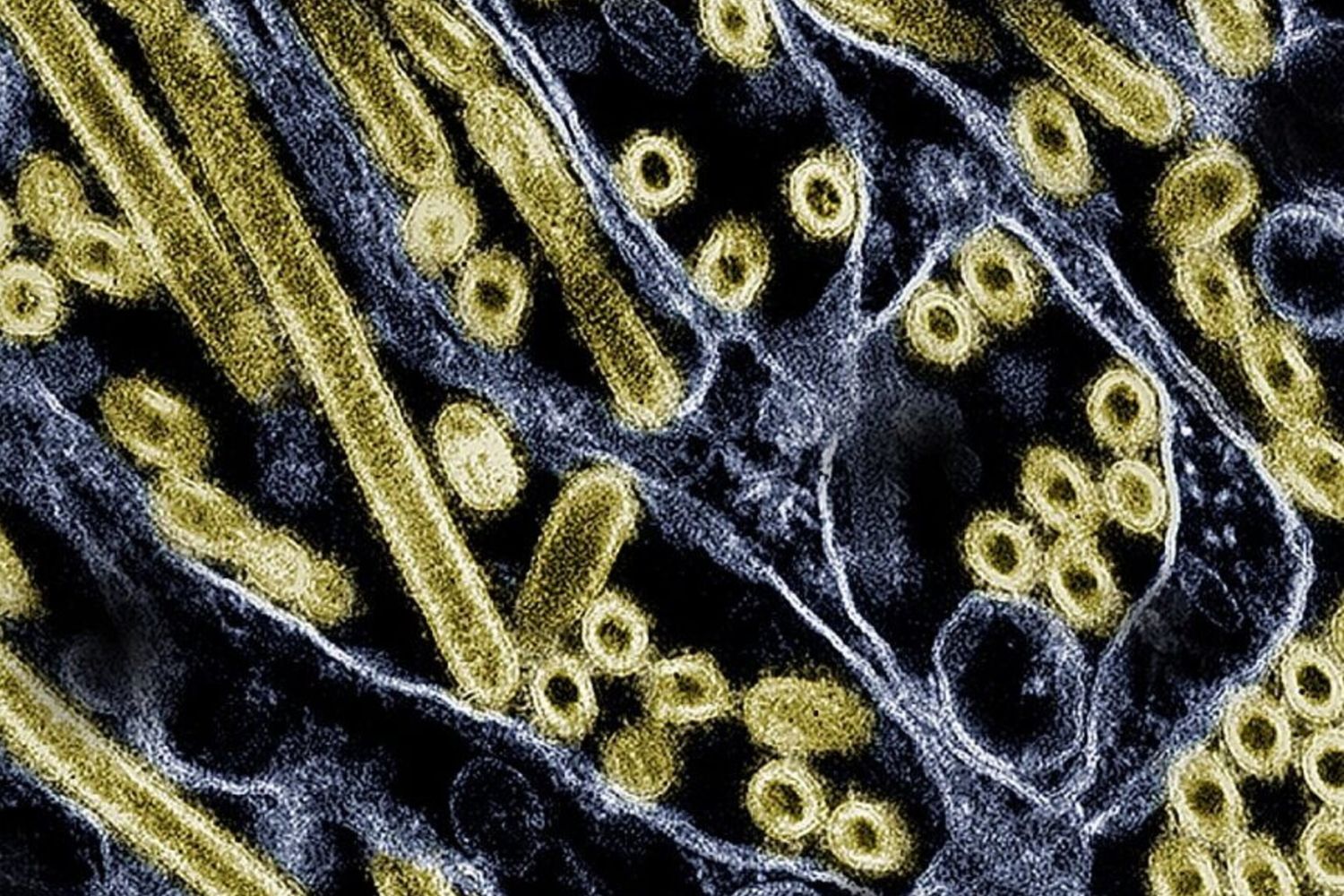 Micrografia elettronica a trasmissione colorata di particelle del virus dell’influenza aviaria A H5N1 (oro), coltivate in cellule epiteliali di Madin-Darby Canine Kidney (MDCK). Microscopia del CDC; riposizionato e ricolorato dal NIAID