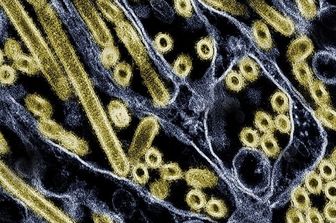 Micrografia elettronica a trasmissione colorata di particelle del virus dell’influenza aviaria A H5N1 (oro), coltivate in cellule epiteliali di Madin-Darby Canine Kidney (MDCK). Microscopia del CDC; riposizionato e ricolorato dal NIAID