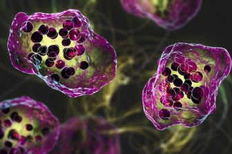 Illustrazione dell'infezione da virus del morbillo