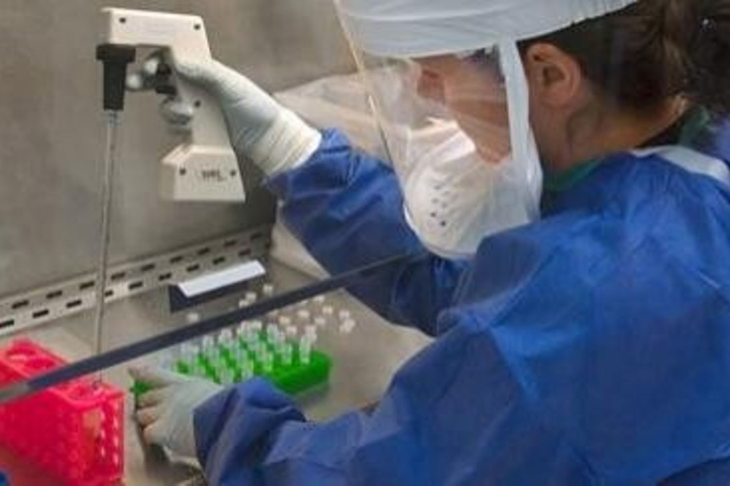 Ospedale pediatrico del Bambin Gesù di Roma,progetto EpIIcal hiv aids