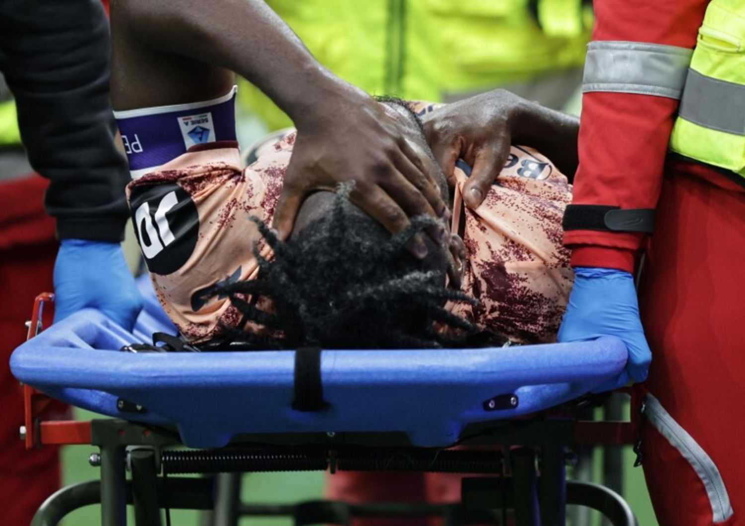 Zapata lascia in barello lo stadio di San Siro