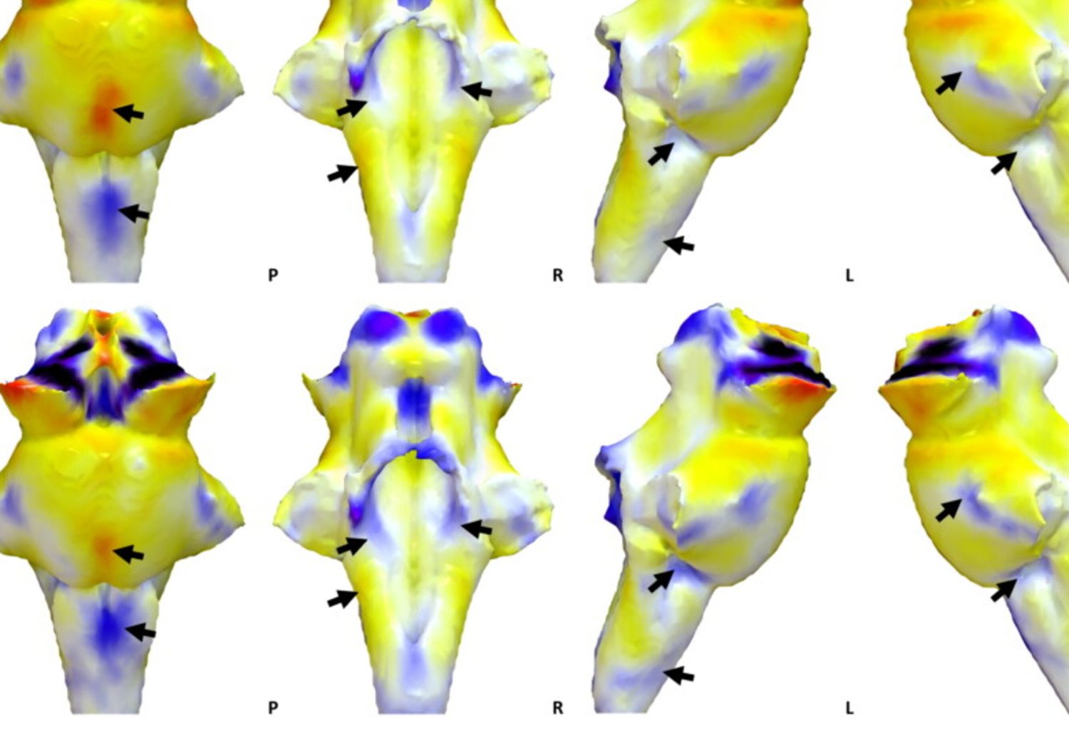 Il long Covid dipende dai danni al sistema di controllo del cervello