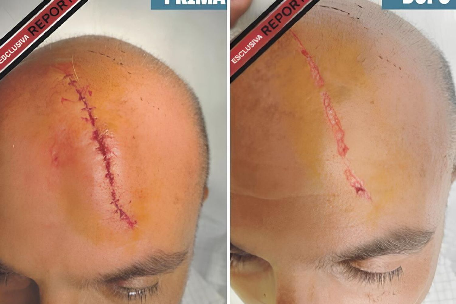 La ferita di Gennaro Sangiuliano mostrata da Report