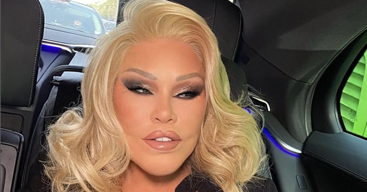 Addio alla 'donna gatto': la regina della chirurgia plastica estrema svanisce