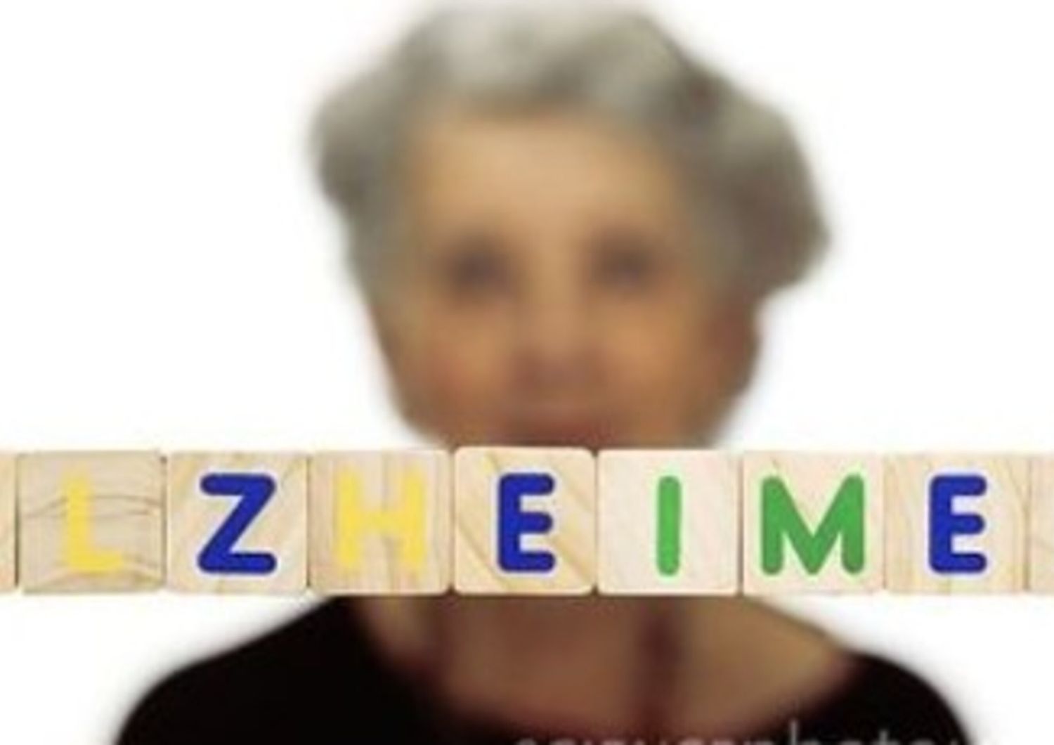 Alzheimer