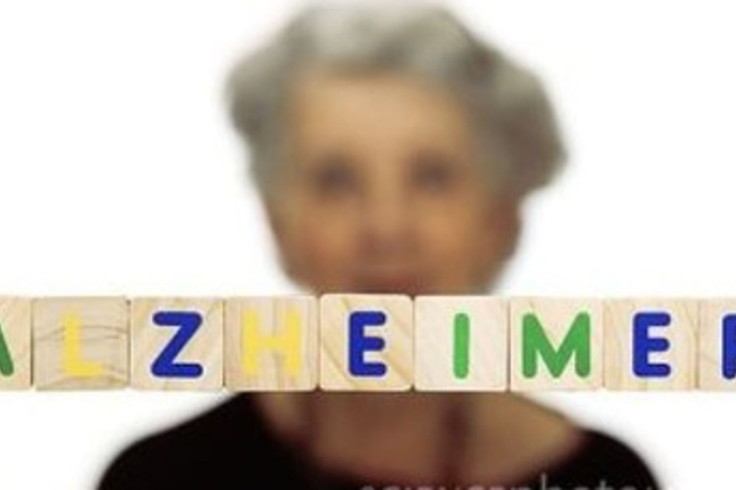 Alzheimer
