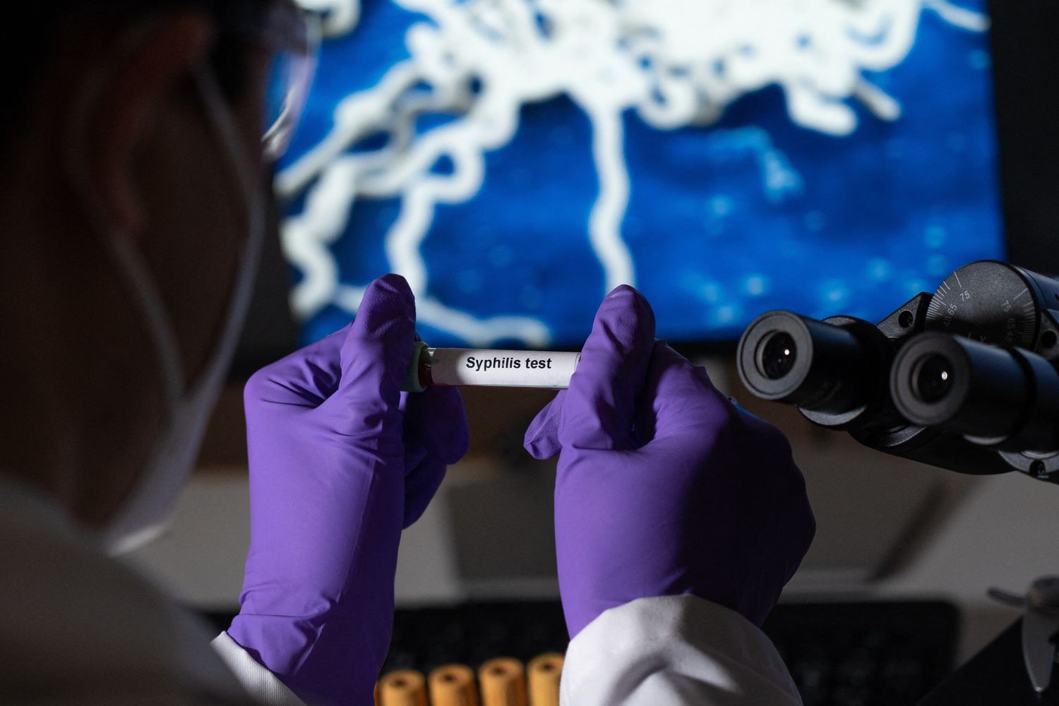 Test per la sifilide