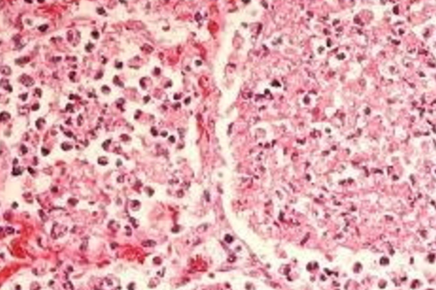 Alcuni laghi possono nascondere la legionella