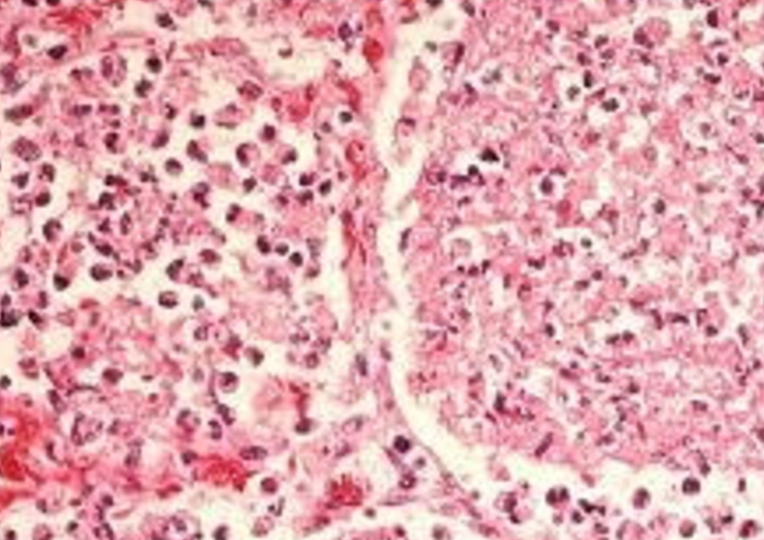 Alcuni laghi possono nascondere la legionella