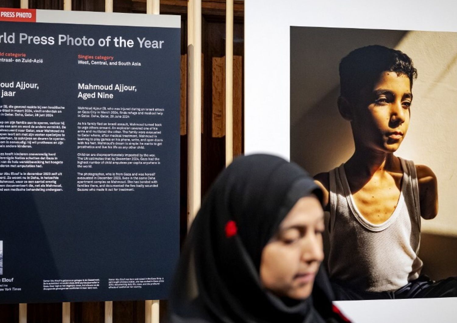 bimbo gaza braccia amputate world press photo