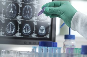 Demenza, studi sul comportamento del cervello