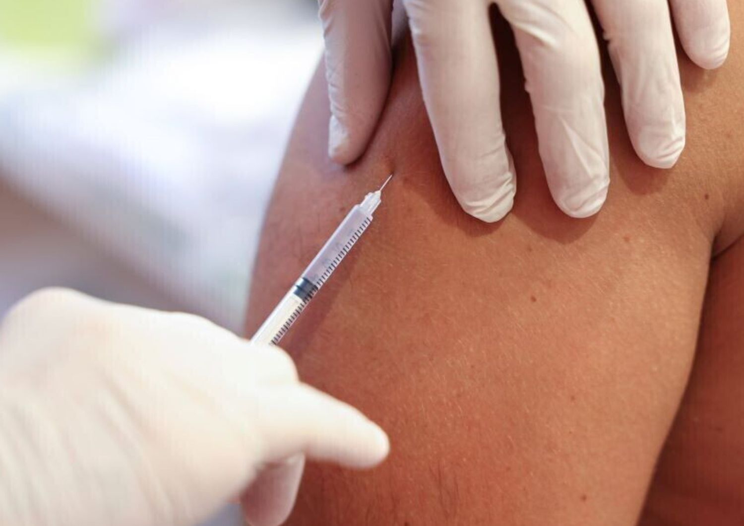 Il vaccino contro l’herpes zoster riduce del 23% il rischio di ictus e patologie cardiache