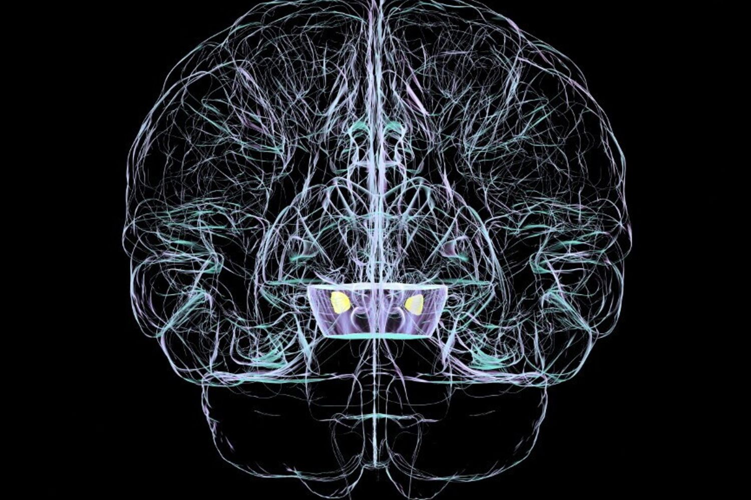 Nuovo esame per rilevare il Parkinson