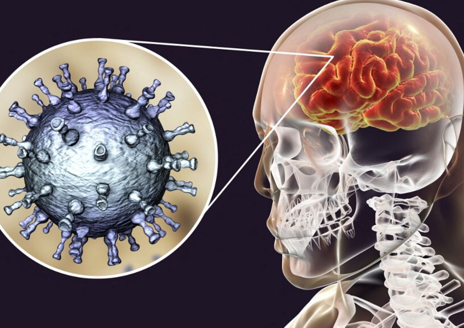 herpes-simplex-virus-1-associato-rischio-aumentato-alzheimer