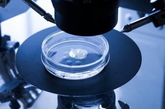 fecondazione assistita