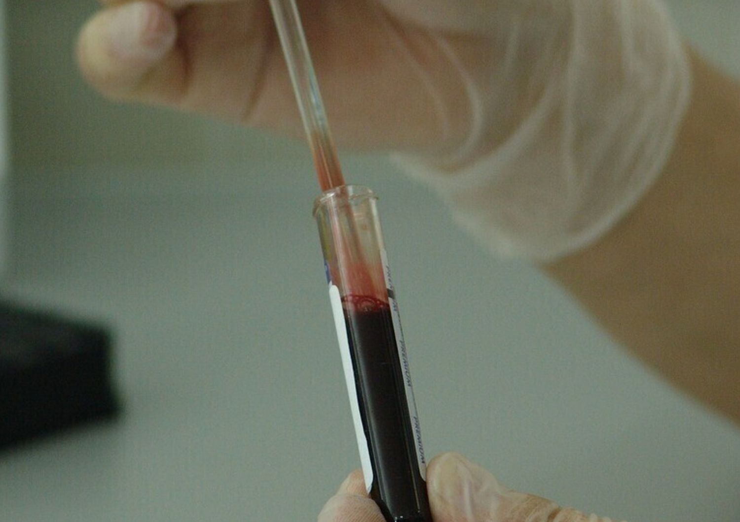 Analisi sangue esami test laboratorio genetica fertilità  - pixabay
