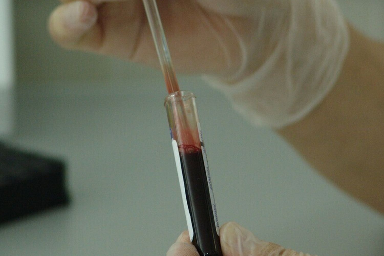 Analisi sangue esami test laboratorio genetica fertilità  - pixabay